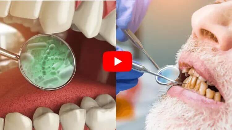 Split-screen image showing dental treatment and examination