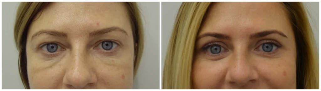 Lisa's transformation